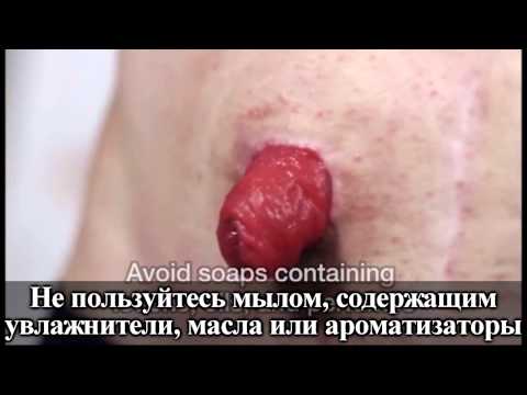 Дорогая, я организовал нашу свадьбу Выпуски 1-10 ( Деформация ногтевых пластин на руках: почему это