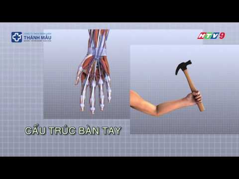 Hội chứng De Quervain là gì ? | Bệnh Viện Thánh Mẫu