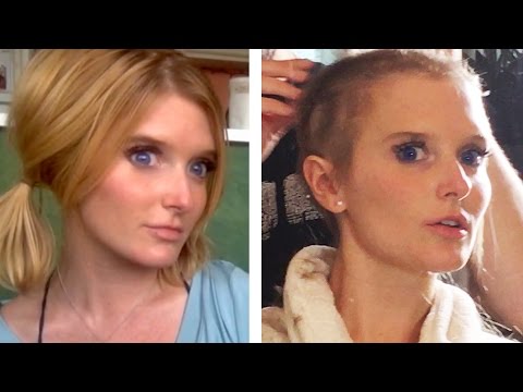 What It Feels Like To Lose My Hair