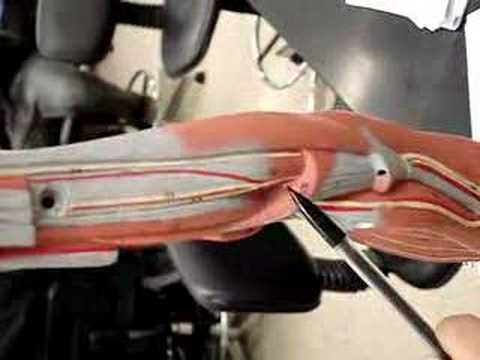 Nerves Of The Arm. model-nerves in the arm