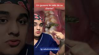 Le Sale Un Gusano Al Diente De Mi Paciente?