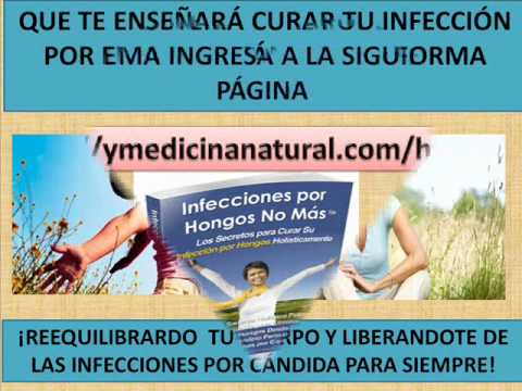 El hongo sobre los dedos de las manos bajo las uñas de la foto