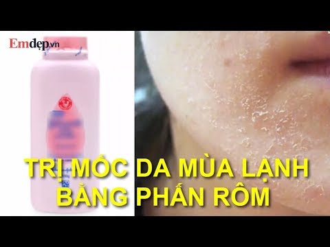 KHÔNG LO MỐC DA MÙA ĐÔNG chỉ bằng 1 lọ PHẤN RÔM TRẺ EM