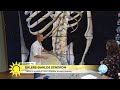 Doktor Mikael om den ovanliga sjukdomen EDS: ”En av tiotusen drabbas” - Nyhetsmorgon (TV4)
