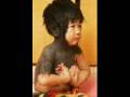Hypertrichosis Treatment | RM. Hypertrichosis Treatment | RM.
