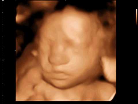 Black And White 4d Ultrasound. Ultrasound video clip made at