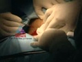 image Caesarean Pulse 18 June Part 1