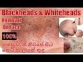 Blackheads & whiteheads removal at home 2020|ru rahas|sinhala Beauty tips|srilankan beauty tips