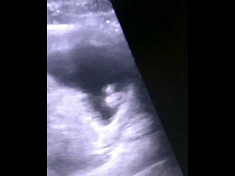 Video Asuransi Bayi 2 Bulan