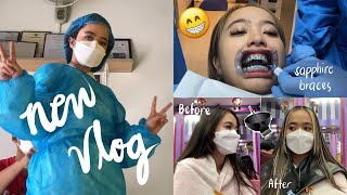 Vlog New Hair Sapphire Braces Annamarie
