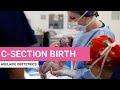 C-sections: Giving birth by cesarean section