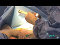 The Park Clinic - First Person POV Breast Augmentation Surgery (x 2)