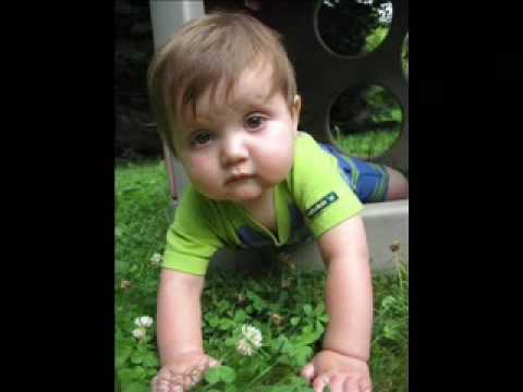 Doctor Bhadwell explains signs and symptoms of Zellweger's Syndrome. Doctor Bhadwell explains signs and symptoms of Zellweger's Syndrome.