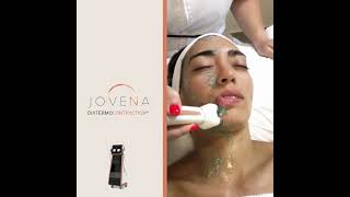𝐅𝐀𝐂𝐄 𝐋𝐈𝐅𝐓𝐈𝐍𝐆 In A Natural Way With 𝐉𝐨𝐯𝐞𝐧𝐚