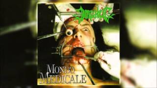Watch Impaled Mondo Medicale video