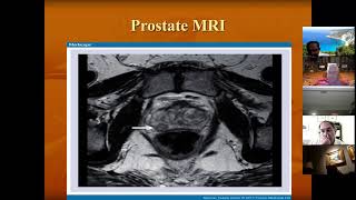 21-10. Dr Ashok Kar "Changing Paradigm in Management of Prostate Cancer" Oct 28 2021