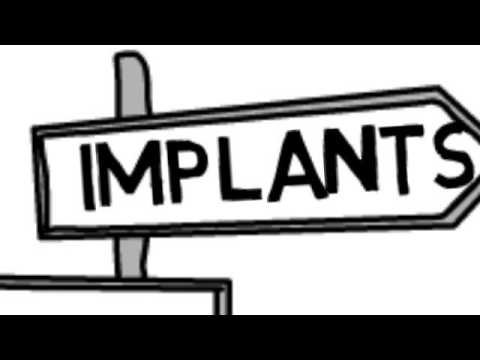 DENTAL IMPLANTS GRANDVIEW TX:GRANDVIEW TX DENTAL IMPLANTS