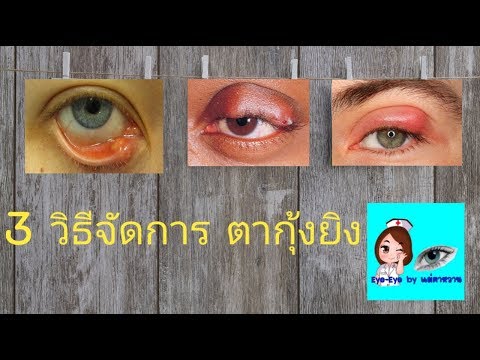 3 วิธี พิชิตตากุ้งยิง