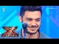 İlyas Yalçıntaş - İncir Performansı - X Factor Star Işığı