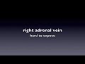 Hard exposure of right adrenal vein during robotic adrenalectomy