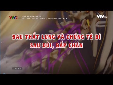 Đau thắt lưng và chứng bệnh tê bì sau đùi - bắp chân