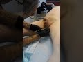 genital piercing