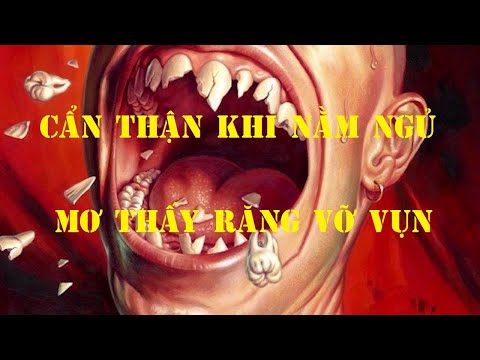 Nằm mơ thấy rụng răng là điềm báo gì? Tin DỮ hay LÀNH || Khám phá tâm linh