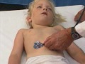 ImedrxTv The Video Blog Examination of Child Abdomen