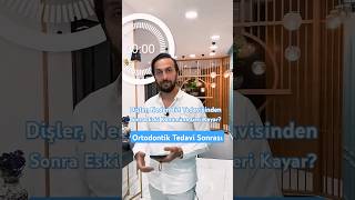 Diş Teli Çıktıktan Sonra Dişler Yeniden Bozulur Mu? Ortodontik Tedavi Dr. Onur Anlatıyor