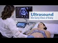 ULTRASOUND: An Early View of Baby