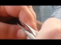 Dog S Boil Pimple Cyst Abscess Pickel Removing From Back images Dog S Boil Pimple Cyst Abscess Pickel Removing From Back