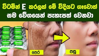 සම ඇත අඳර ලප කළල සථරවම ඉවත කරන සවභවක කරම 10ක 10 Home Remedies For Pigmentation