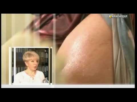 Роспотребнадзор: на Кубани нет эпидемии гриппа и ОРВИ Роспотребнадзор: на Кубани нет эпидемии гриппа и ОРВИ