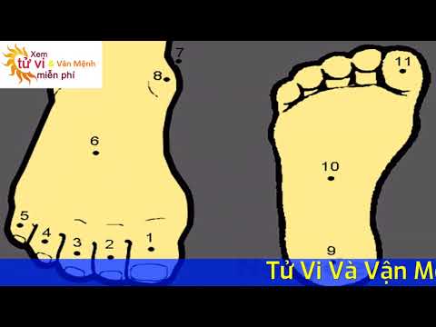 Xem tướng 11 nốt ruồi ở bàn chân của phụ nữ và nam giới