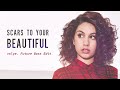 Alessia Cara - Scars To Your Beautiful (vslye. Future Bass Edit)