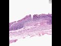 Shotgun Histology Gastro-Esophageal Junction