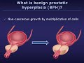 Understanding Benign Prostatic Hyperplasia (BPH)