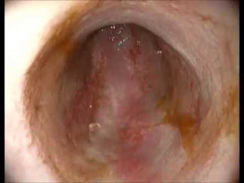 gastroenteritis in dogs hemorrhagic gastroenteritis gastroenteritis in dogs hemorrhagic gastroenteritis