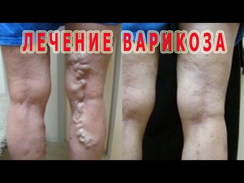 Вязание детям и подросткам » Вязание, вязание спицами Вязание - шапки, береты Марина Ветрова Простые схемы. Экономим время