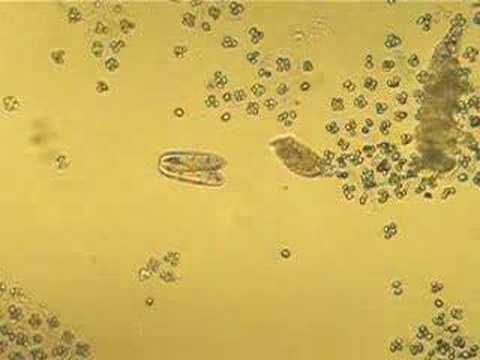Paramecium conjugating joined together with the oral grooves aligned.