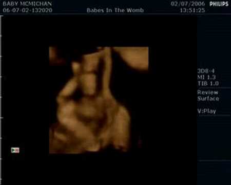 My son Travis 4D Ultrasound Video, 24 weeks. My son Travis 4D Ultrasound Video, 24 weeks. 3:10. This is a 4D Ultrasound of my son Travis when he was 24