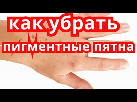 От дезодоранта пятна на коже От дезодоранта пятна на коже
