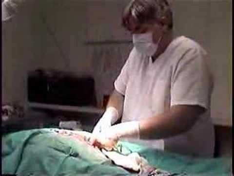 WARNING-ACTUAL C-SECTION SURGERY-BULLMASTIFF BABIES PT. 2