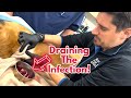 Vet drains dog abscess.  Dr. Dan shows how a vet fixes an abscess