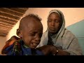 Desnutrición en Chad: "Si no llueve moriremos"