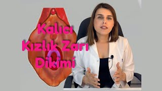 Kalıcı Kızlık Zarı Dikimi Sonrası Kanama Olur Mu? - Op. Dr. Funda Yazıcı Erol