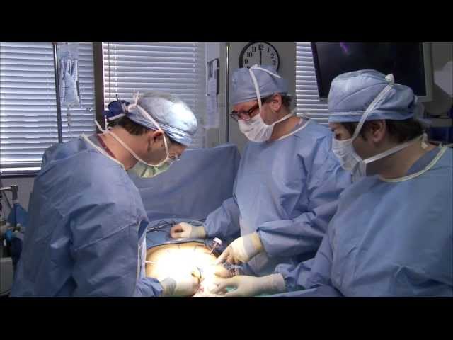 Complex Hernia Repair at ROX Hernia Center Los Angeles