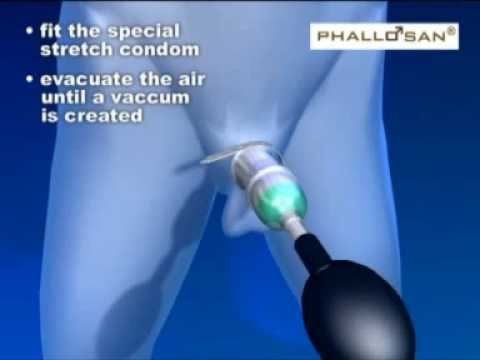 Phallosan - How it works