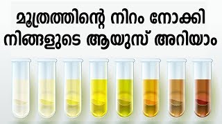 മൂത്രത്തിന്റെ നിറം പറയും നിങ്ങളുടെ ആയുസ് | Health Tips In Malayalam | Healthy Kerala