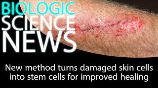 Science News - New method turns damaged skin cells into stem cells for improved healing